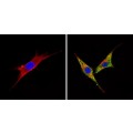 anti-HYAL1 antibody (Hyaluronidase-1) (N-Term)