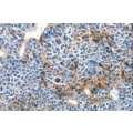 anti-HYAL1 antibody (Hyaluronidase-1) (N-Term)