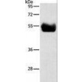 anti-HYAL1 antibody (Hyaluronidase-1) (N-Term)