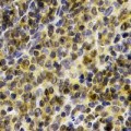 anti-HYAL1 antibody (Hyaluronidase-1) (N-Term)