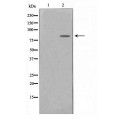 anti-HYAL1 antibody (Hyaluronidase-1) (N-Term)