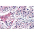 anti-HYAL1 antibody (Hyaluronidase-1) (N-Term)