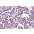 anti-HYAL1 antibody (Hyaluronidase-1) (N-Term)