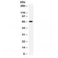 anti-HYAL1 antibody (Hyaluronidase-1) (N-Term)