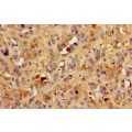 anti-HYAL1 antibody (Hyaluronidase-1) (N-Term)