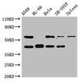 anti-HYAL1 antibody (Hyaluronidase-1) (N-Term)