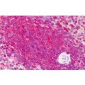 anti-HYAL1 antibody (Hyaluronidase-1) (N-Term)