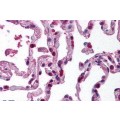 anti-HYAL1 antibody (Hyaluronidase-1) (N-Term)