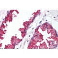 anti-HYAL1 antibody (Hyaluronidase-1) (N-Term)