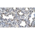 anti-HYAL1 antibody (Hyaluronidase-1) (N-Term)