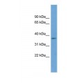 anti-HYAL1 antibody (Hyaluronidase-1) (N-Term)
