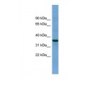 anti-HYAL1 antibody (Hyaluronidase-1) (N-Term)
