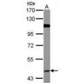 anti-HYAL1 antibody (Hyaluronidase-1) (N-Term)
