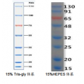 anti-HYAL1 antibody (Hyaluronidase-1) (N-Term)