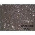 anti-HYAL1 antibody (Hyaluronidase-1) (N-Term)