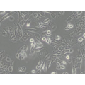 anti-HYAL1 antibody (Hyaluronidase-1) (N-Term)
