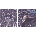 anti-HYAL1 antibody (Hyaluronidase-1) (N-Term)