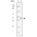 anti-HYAL1 antibody (Hyaluronidase-1) (N-Term)