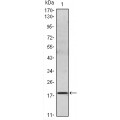 anti-HYAL1 antibody (Hyaluronidase-1) (N-Term)