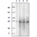 anti-HYAL1 antibody (Hyaluronidase-1) (N-Term)