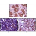 anti-HYAL1 antibody (Hyaluronidase-1) (N-Term)