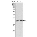 anti-HYAL1 antibody (Hyaluronidase-1) (N-Term)