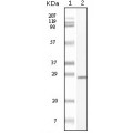 anti-HYAL1 antibody (Hyaluronidase-1) (N-Term)