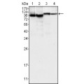 anti-HYAL1 antibody (Hyaluronidase-1) (N-Term)