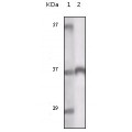 anti-HYAL1 antibody (Hyaluronidase-1) (N-Term)