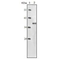 anti-HYAL1 antibody (Hyaluronidase-1) (N-Term)