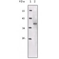 anti-HYAL1 antibody (Hyaluronidase-1) (N-Term)
