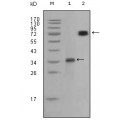 anti-HYAL1 antibody (Hyaluronidase-1) (N-Term)