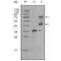 anti-HYAL1 antibody (Hyaluronidase-1) (N-Term)