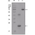 anti-HYAL1 antibody (Hyaluronidase-1) (N-Term)