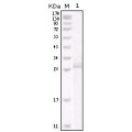 anti-HYAL1 antibody (Hyaluronidase-1) (N-Term)