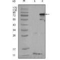 anti-HYAL1 antibody (Hyaluronidase-1) (N-Term)