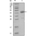 anti-HYAL1 antibody (Hyaluronidase-1) (N-Term)