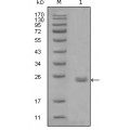 anti-HYAL1 antibody (Hyaluronidase-1) (N-Term)