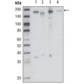 anti-HYAL1 antibody (Hyaluronidase-1) (N-Term)