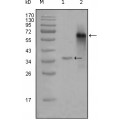 anti-HYAL1 antibody (Hyaluronidase-1) (N-Term)