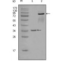 anti-HYAL1 antibody (Hyaluronidase-1) (N-Term)