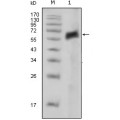 anti-HYAL1 antibody (Hyaluronidase-1) (N-Term)