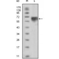 anti-HYAL1 antibody (Hyaluronidase-1) (N-Term)