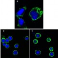 anti-HYAL1 antibody (Hyaluronidase-1) (N-Term)