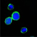 anti-HYAL1 antibody (Hyaluronidase-1) (N-Term)