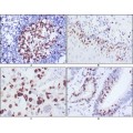 anti-HYAL1 antibody (Hyaluronidase-1) (N-Term)