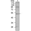 anti-HYAL1 antibody (Hyaluronidase-1) (N-Term)