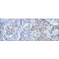 anti-HYAL1 antibody (Hyaluronidase-1) (N-Term)