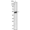 anti-HYAL1 antibody (Hyaluronidase-1) (N-Term)