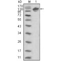 anti-HYAL1 antibody (Hyaluronidase-1) (N-Term)